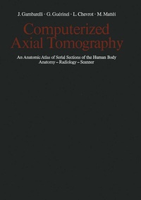 Enlarge image Cover: Computerized Axial Tomography - Springer