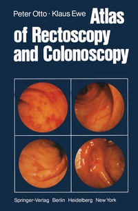 Abbildung von: Atlas of Rectoscopy and Coloscopy - Springer