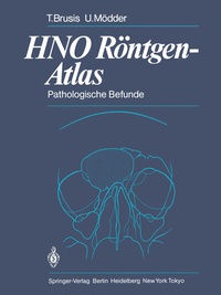 Abbildung von: HNO Röntgen-Atlas - Springer