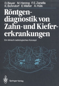 Abbildung von: Röntgendiagnostik von Zahn- und Kiefererkrankungen - Springer