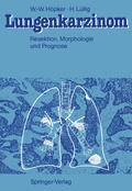 Cover: Lungenkarzinom - Springer