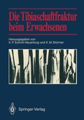 Cover: Die Tibiaschaftfraktur beim Erwachsenen - Springer