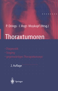 Abbildung von: Thoraxtumoren - Springer