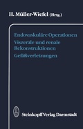 Bild: Endovaskul&auml;re Operationen Viszerale und renale Rekonstruktionen Gef&auml;&szlig;verletzungen - Steinkopff