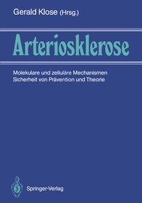 Abbildung von: Arteriosklerose - Springer