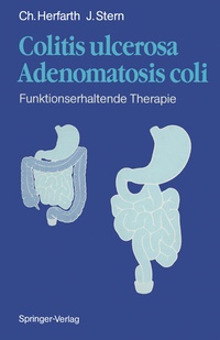 Abbildung von: Colitis ulcerosa - Adenomatosis coli - Springer