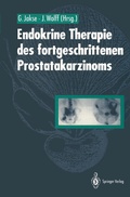 Cover: Endokrine Therapie des fortgeschrittenen Prostatakarzinoms - Springer