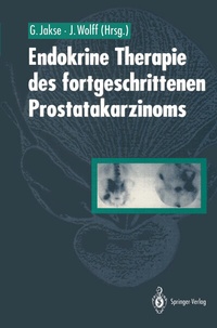 Abbildung von: Endokrine Therapie des fortgeschrittenen Prostatakarzinoms - Springer