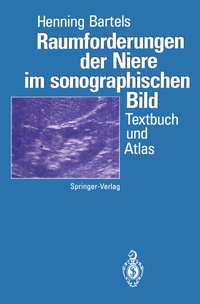 Abbildung von: Raumforderungen der Niere im sonographischen Bild - Springer