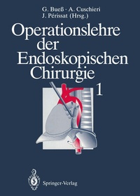 Abbildung von: Operationslehre der Endoskopischen Chirurgie 1 - Springer