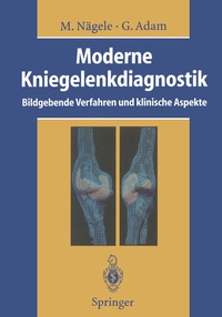 Abbildung von: Moderne Kniegelenkdiagnostik - Springer