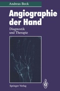 Cover: Angiographie der Hand - Springer