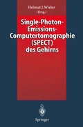 Abbildung von: Single-Photon-Emissions-Computertomographie (SPECT) des Gehirns - Springer