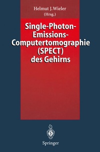 Abbildung von: Single-Photon-Emissions-Computertomographie (SPECT) des Gehirns - Springer