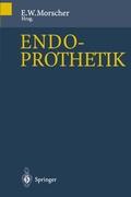 Cover: Endoprothetik - Springer