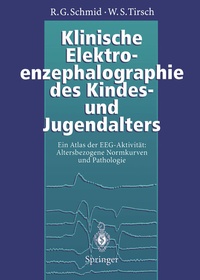 Abbildung von: Klinische Elektroenzephalographie des Kindes- und Jugendalters - Springer