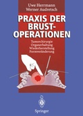 Cover: Praxis der Brustoperationen - Springer