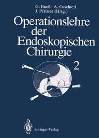 Abbildung von: Operationslehre der Endoskopischen Chirurgie - Springer