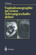 Cover: Vaginalsonographie im ersten Schwangerschaftsdrittel - Springer