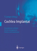 Cover: Cochlea-Implantat - Springer