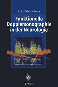 Abbildung von: Funktionelle Dopplersonographie in der Neurologie - Springer