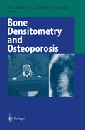 Cover: Bone Densitometry and Osteoporosis - Springer