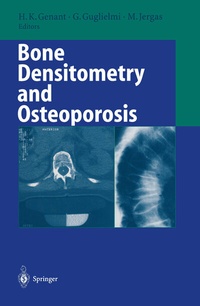 Abbildung von: Bone Densitometry and Osteoporosis - Springer