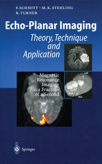 Abbildung von: Echo-Planar Imaging - Springer