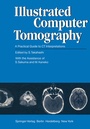 Cover: Illustrated Computer Tomography - Springer