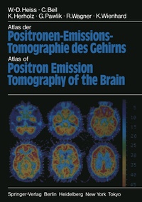 Abbildung von: Atlas der Positronen-Emissions-Tomographie des Gehirns / Atlas of Positron Emission Tomography of the Brain - Springer