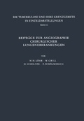 Cover: Beitr&auml;ge zur Angiographie Chirurgischer Lungenerkrankungen - Springer