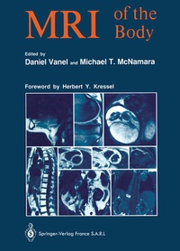 Abbildung von: MRI of the Body - Springer