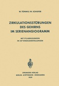 Cover: Zirkulationsst&ouml;rungen des Gehirns im Serienangiogramm - Springer