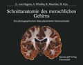 Abbildung von: Schnittanatomie des menschlichen Gehirns - Steinkopff