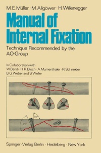 Enlarge image Cover: Manual of Internal Fixation - Springer