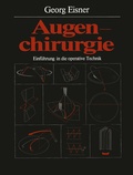 Cover: Augenchirurgie - Springer