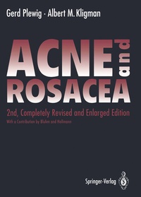 Enlarge image Cover: ACNE and ROSACEA - Springer