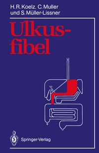 Abbildung von: Ulkusfibel - Springer