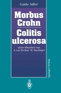 Cover: Morbus Crohn Colitis ulcerosa - Springer