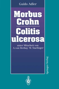 Abbildung von: Morbus Crohn Colitis ulcerosa - Springer