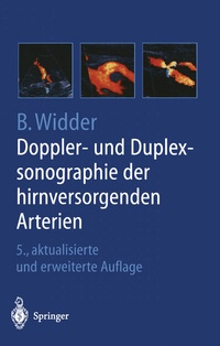 Abbildung von: Doppler- und Duplexsonographie der hirnversorgenden Arterien - Springer