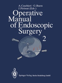 Abbildung von: Operative Manual of Endoscopic Surgery 2 - Springer