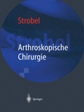 Cover: Arthroskopische Chirurgie - Springer