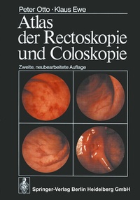 Abbildung von: Atlas der Rectoskopie und Coloskopie - Springer