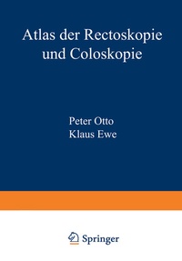 Abbildung von: Atlas der Rectoskopie und Coloskopie - Springer