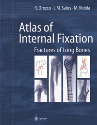 Enlarge image Cover: Atlas of Internal Fixation - Springer