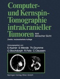 Abbildung von: Computer- und Kernspin-Tomographie intrakranieller Tumoren aus klinischer Sicht - Springer