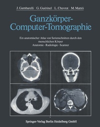 Abbildung von: Ganzkörper-Computer-Tomographie - Springer