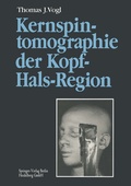 Cover: Kernspintomographie der Kopf-Hals-Region - Springer