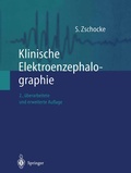 Abbildung von: Klinische Elektroenzephalographie - Springer